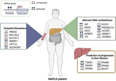 An Update in Epigenetics in Metabolic-Associated Fatty Liver Disease
